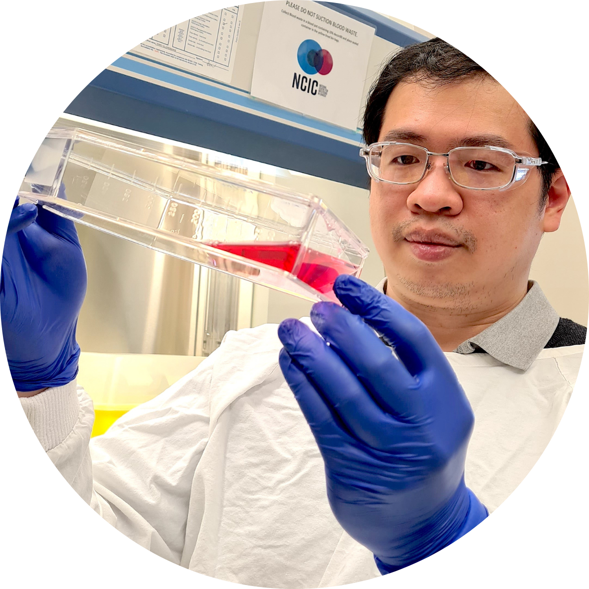 Dr Eric Kusnadi Cure Cancer Funded Researcher Dr Eric Kusnadi Cure Cancer Funded Researcher